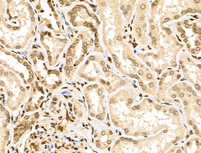 MLH3 Antibody in Immunohistochemistry (Paraffin) (IHC (P))