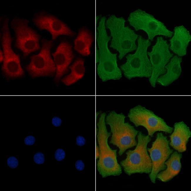 RPS18 Antibody in Immunocytochemistry (ICC/IF)