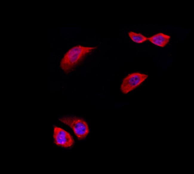 RPL5 Antibody in Immunocytochemistry (ICC/IF)