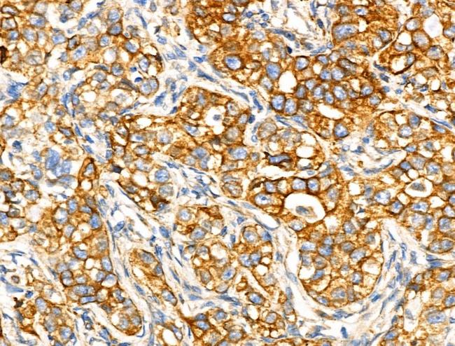 ACOT4 Antibody in Immunohistochemistry (Paraffin) (IHC (P))