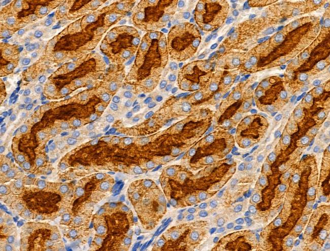 SLC25A6 Antibody in Immunohistochemistry (Paraffin) (IHC (P))