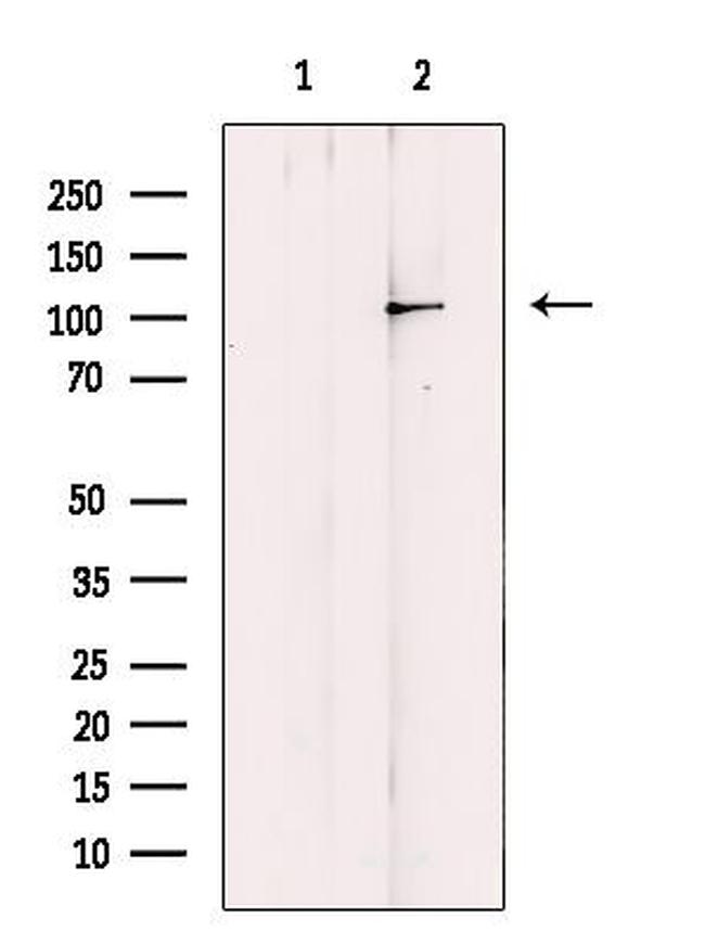 EPB41L2 Antibody in Western Blot (WB)