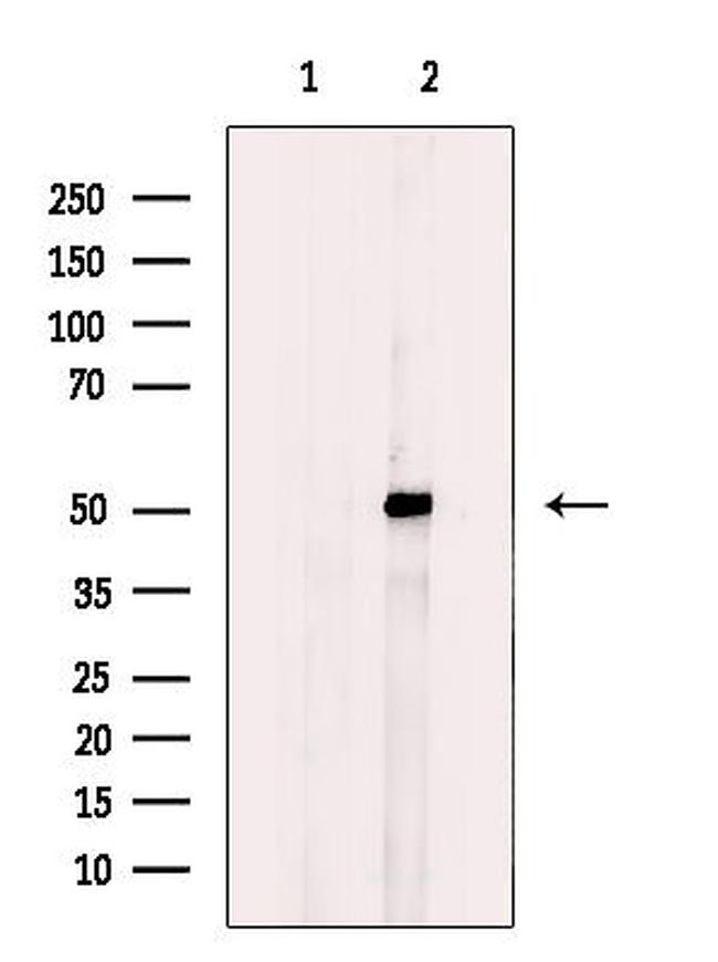 GCNT7 Antibody in Western Blot (WB)