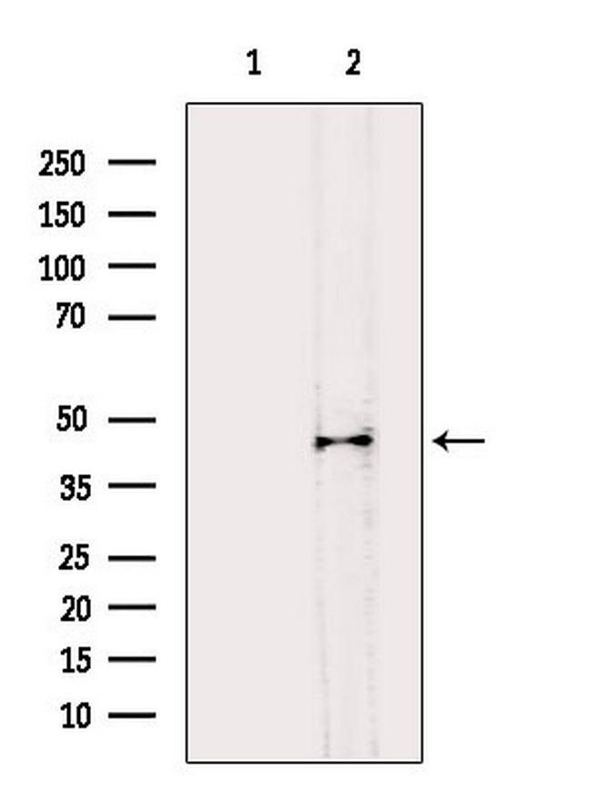 B4GALT1 Antibody in Western Blot (WB)