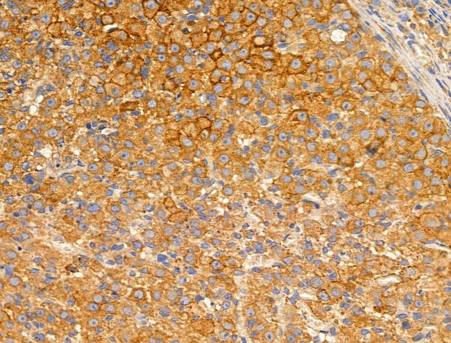 GUSB Antibody in Immunohistochemistry (Paraffin) (IHC (P))