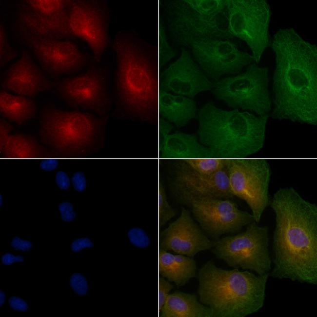 BMP-10 Antibody in Immunocytochemistry (ICC/IF)