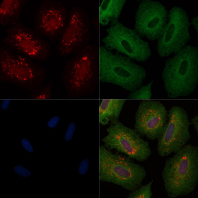 CHP1 Antibody in Immunocytochemistry (ICC/IF)