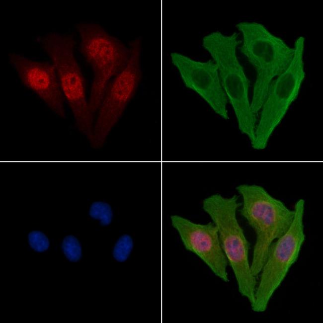 Calpain 10 Antibody in Immunocytochemistry (ICC/IF)