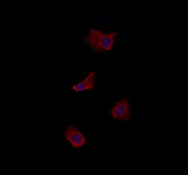 CLIP2 Antibody in Immunocytochemistry (ICC/IF)