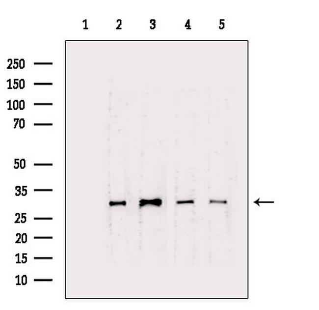 CTDSP1 Antibody in Western Blot (WB)