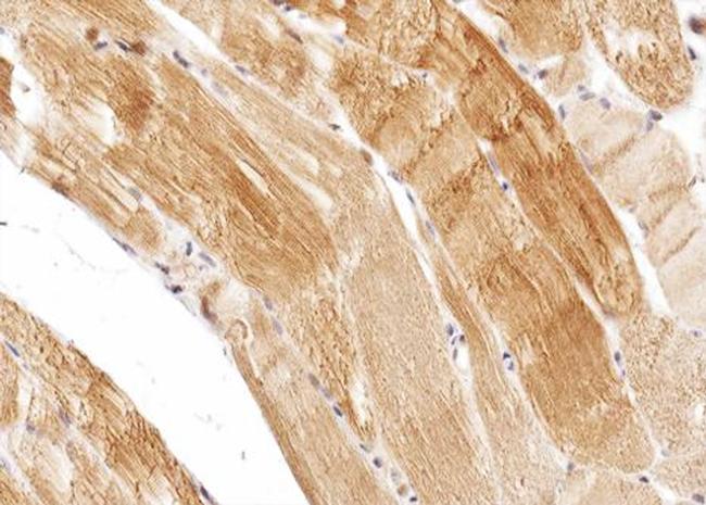 CPT1B Antibody in Immunohistochemistry (Paraffin) (IHC (P))