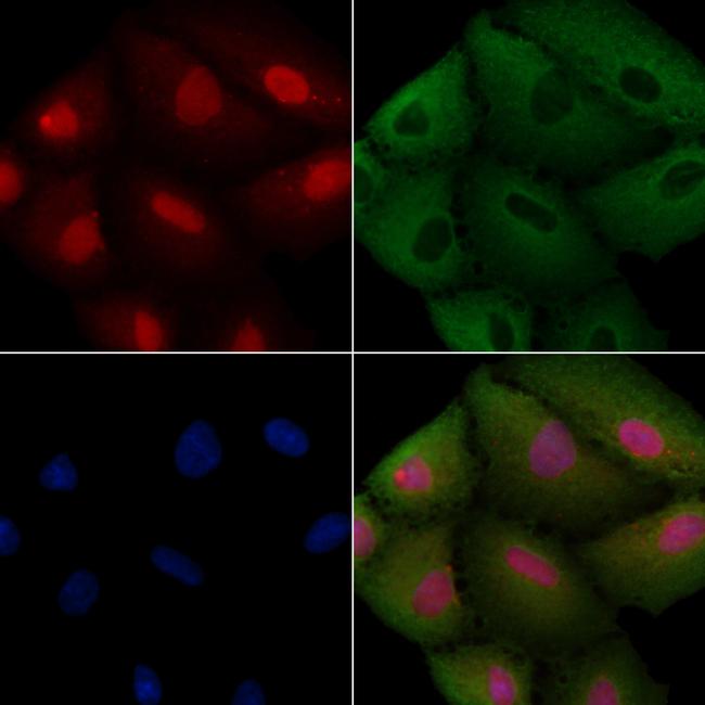 CEP57 Antibody in Immunocytochemistry (ICC/IF)