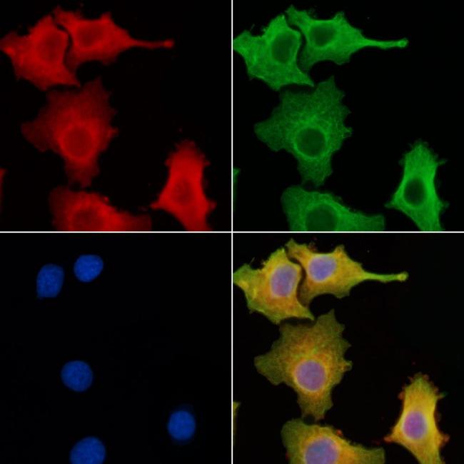 CLCC1 Antibody in Immunocytochemistry (ICC/IF)