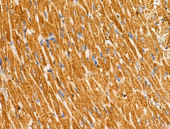 CMTM2 Antibody in Immunohistochemistry (Paraffin) (IHC (P))