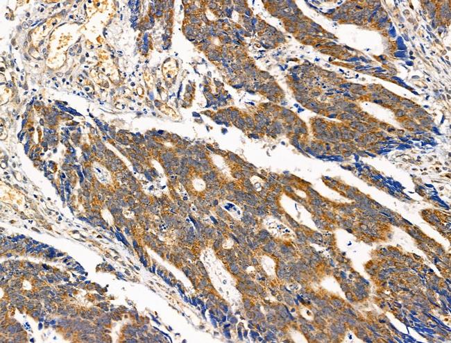 ST6GAL1 Antibody in Immunohistochemistry (Paraffin) (IHC (P))