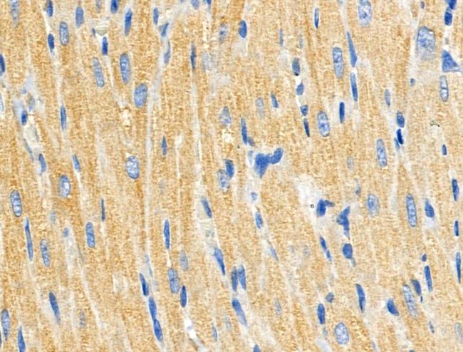 C1QC Antibody in Immunohistochemistry (Paraffin) (IHC (P))