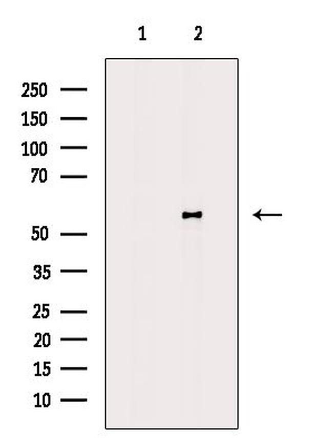 ATG4D Antibody in Western Blot (WB)