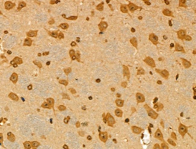 PRIM1 Antibody in Immunohistochemistry (Paraffin) (IHC (P))