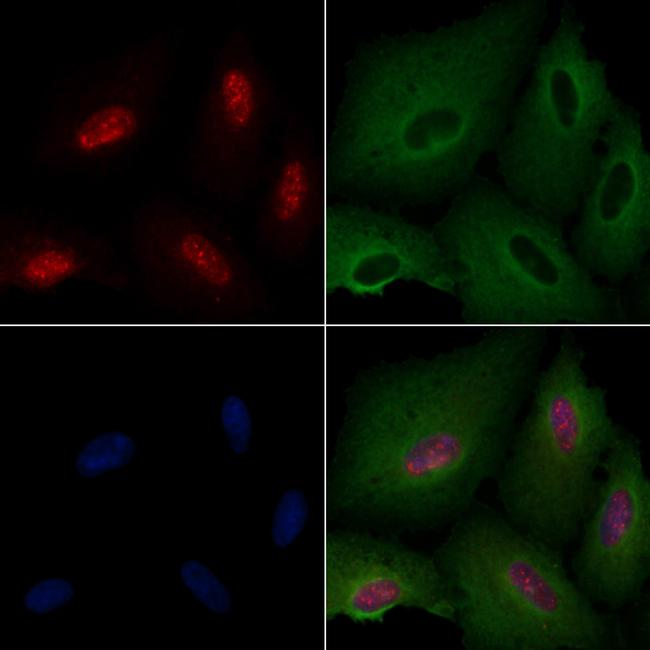 POLR1B Antibody in Immunocytochemistry (ICC/IF)