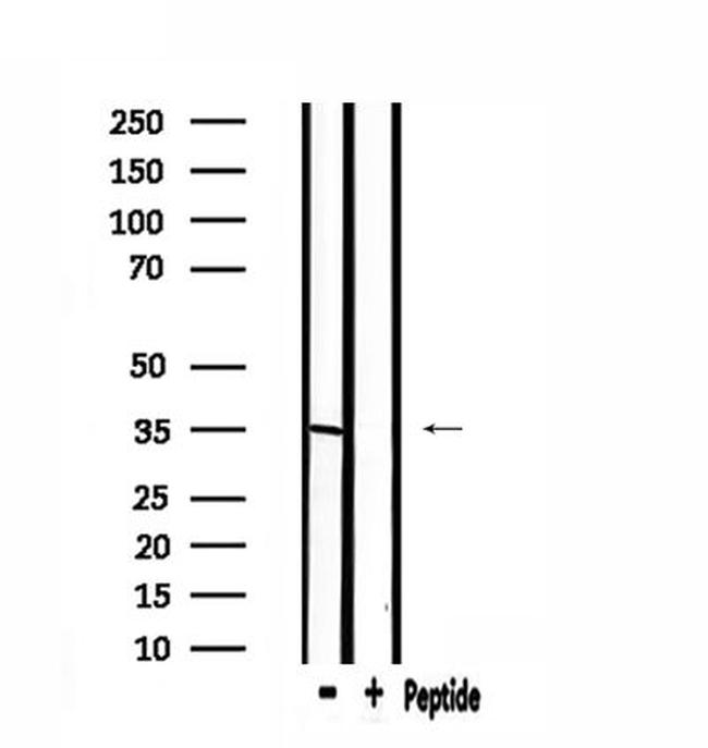 ELOVL6 Antibody in Western Blot (WB)