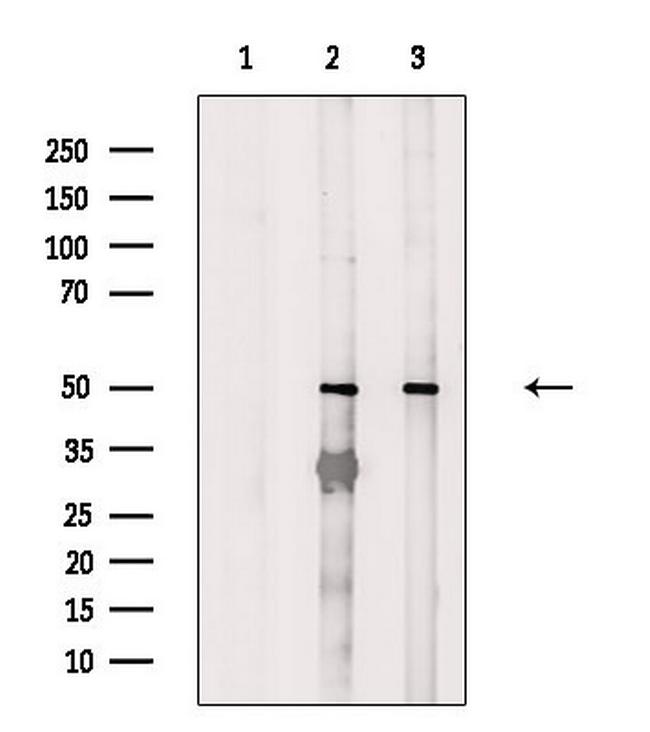 FOXN4 Antibody in Western Blot (WB)