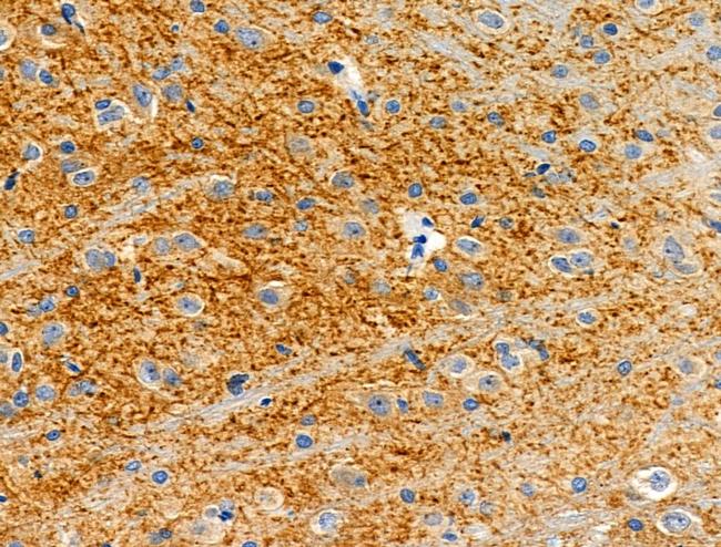 SLC16A13 Antibody in Immunohistochemistry (Paraffin) (IHC (P))