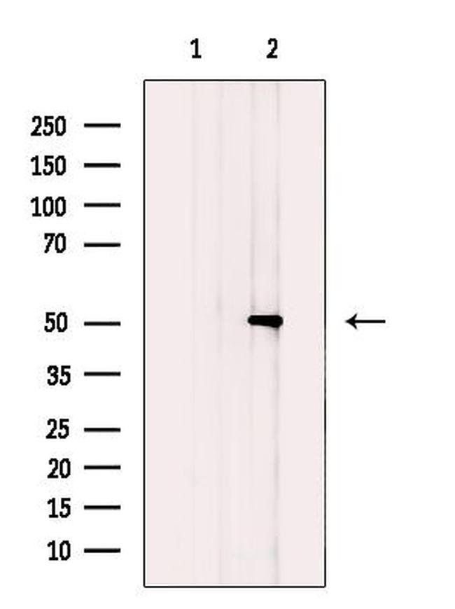 SLC16A3 Antibody in Western Blot (WB)