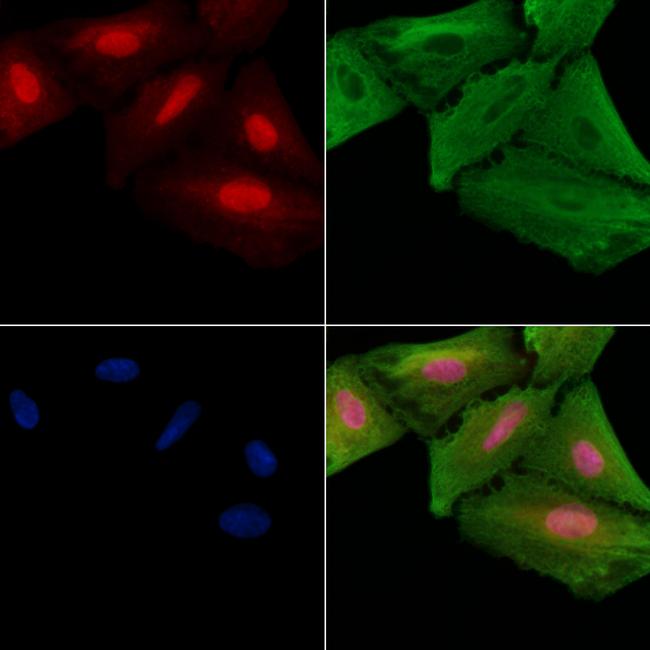 NUSAP1 Antibody in Immunocytochemistry (ICC/IF)