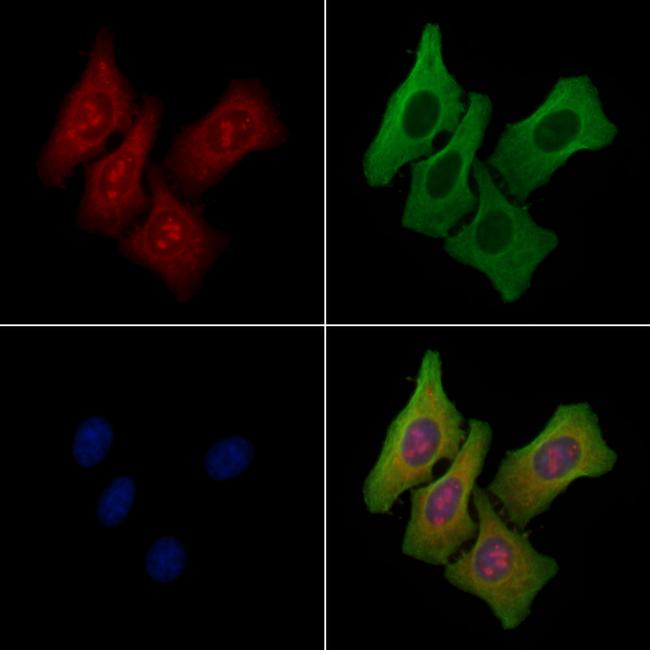 NOLC1 Antibody in Immunocytochemistry (ICC/IF)