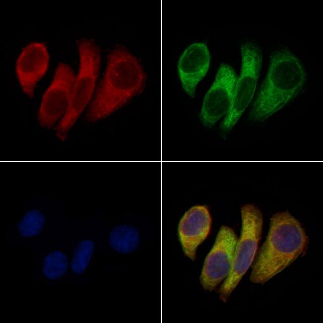 KCNK6 Antibody in Immunocytochemistry (ICC/IF)