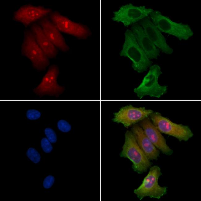 FNTB Antibody in Immunocytochemistry (ICC/IF)