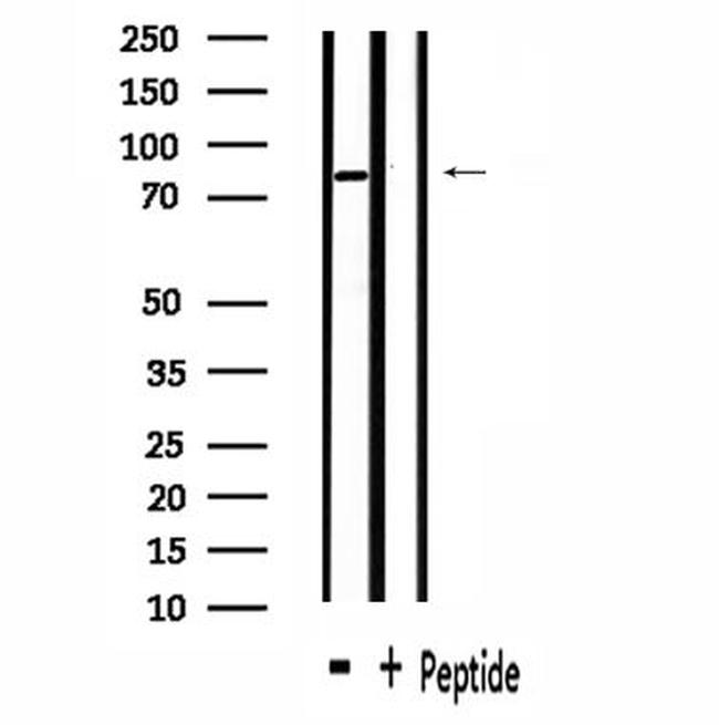 ZFYVE20/Rabenosyn 5 Antibody in Western Blot (WB)