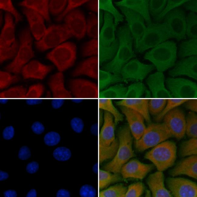 RAB26 Antibody in Immunocytochemistry (ICC/IF)