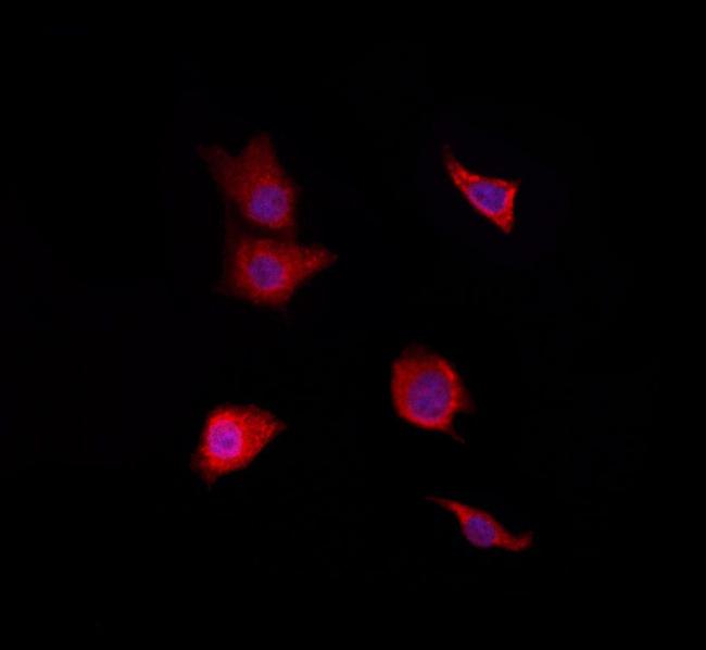 RAB38 Antibody in Immunocytochemistry (ICC/IF)