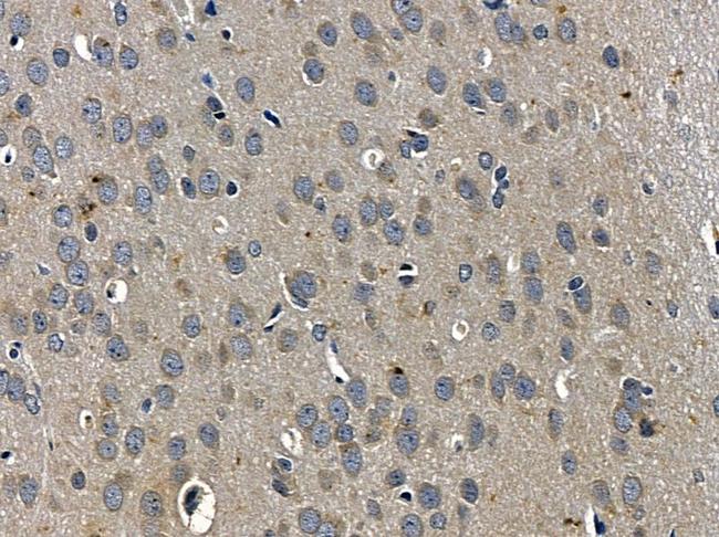 ARHGDIG Antibody in Immunohistochemistry (Paraffin) (IHC (P))