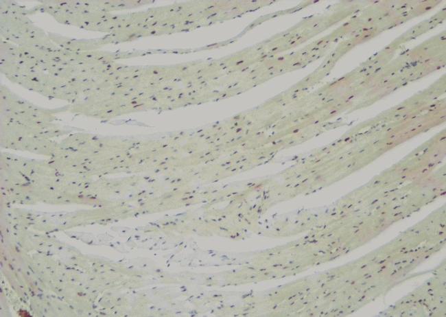 TNNI3K Antibody in Immunohistochemistry (Paraffin) (IHC (P))