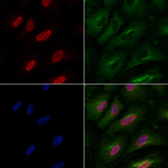 PPP2R5A Antibody in Immunocytochemistry (ICC/IF)