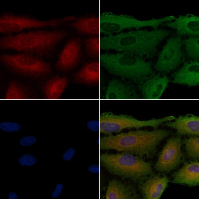 SLC6A1 Antibody in Immunocytochemistry (ICC/IF)