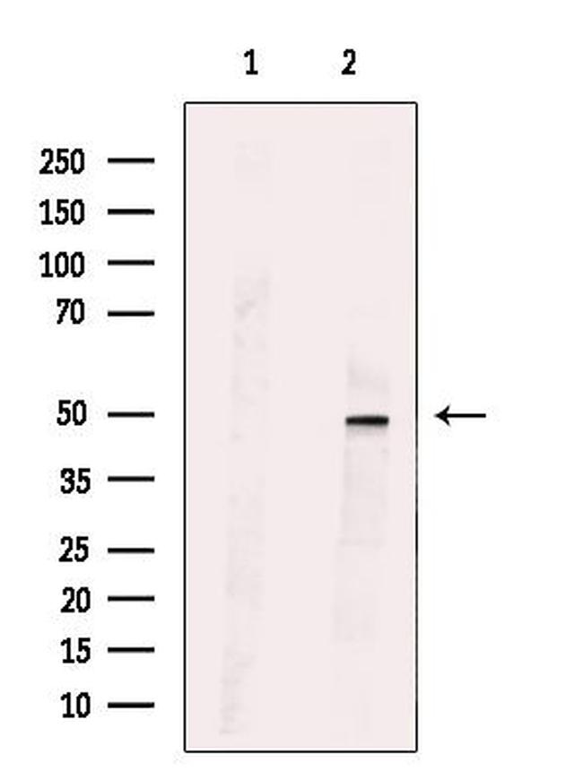 SYT13 Antibody in Western Blot (WB)