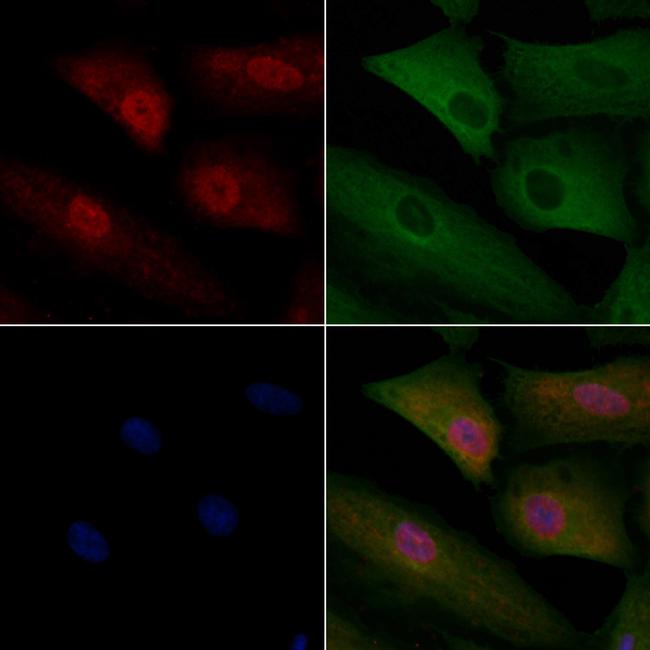 UBAP2L Antibody in Immunocytochemistry (ICC/IF)