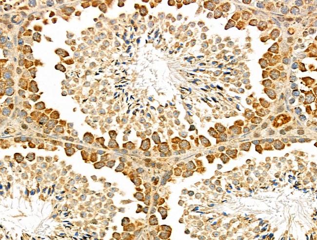 CACNA2D4 Antibody in Immunohistochemistry (Paraffin) (IHC (P))