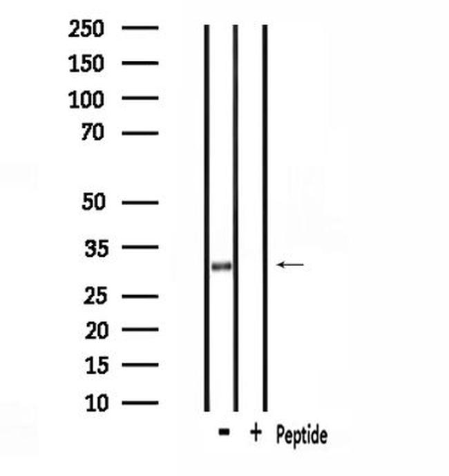 SMUG1 Antibody in Western Blot (WB)