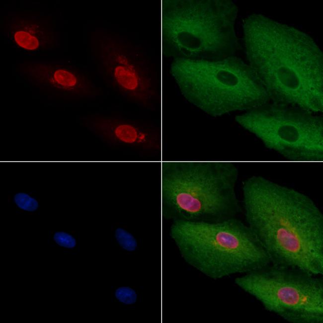 ARX Antibody in Immunocytochemistry (ICC/IF)