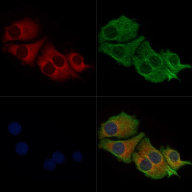 MYL6 Antibody in Immunocytochemistry (ICC/IF)