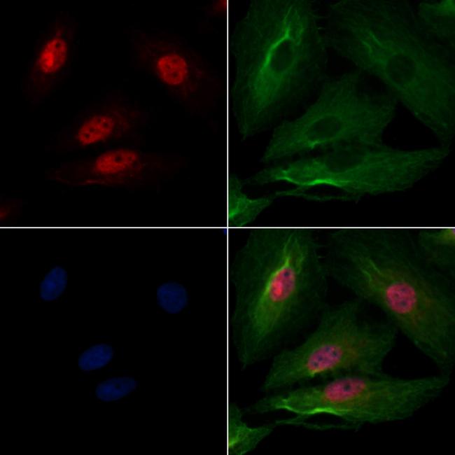 CHFR Antibody in Immunocytochemistry (ICC/IF)