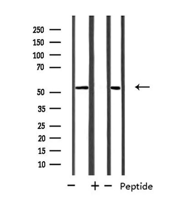 CYP39A1 Antibody in Western Blot (WB)