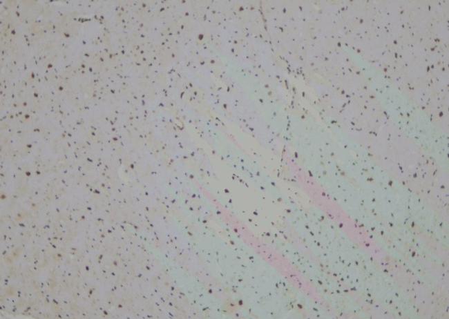 LIM1 Antibody in Immunohistochemistry (Paraffin) (IHC (P))