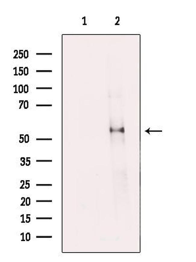 FIBB Antibody in Western Blot (WB)