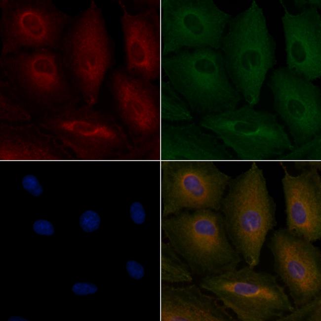 GPR109B Antibody in Immunocytochemistry (ICC/IF)