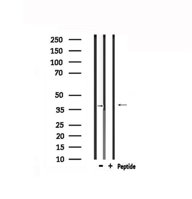 TPRA1 Antibody in Western Blot (WB)